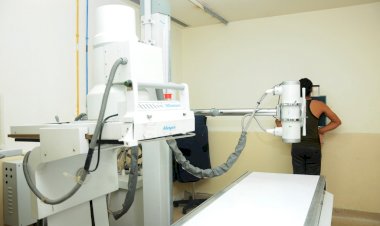 टीबी रोगियों को अब डिजिटल एक्स-रे के लिए नहीं करना होगा इंतजार