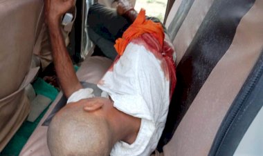 फतेहपुर : हैण्डपम्प में पानी भरने को लेकर विवाद, दबंगों ने मारी गोली