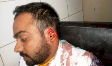 फुटपाथ पर कपड़े बेचने वाले दुकानदार का ग्राहक ने काट लिया बायां कान