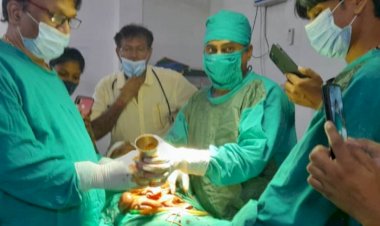 मरीज के पेट से गिलास निकाल कर डॉ ने मरीज की बचाई जान, बना कौतूहल का विषय