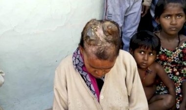 महिला के सिर पर रहस्यमय तरीके से निकल रहे हैं सींग, डॉक्टर भी हैरान