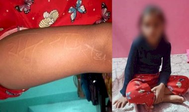 इस बच्ची के शरीर पर उभर रहे हैं राधे व राम के नाम, चमत्कार या रिएक्शन
