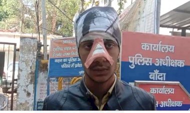 हमलावरों ने सीटीओ के बेटे की पीट पीट कर नाक तोड़ दी