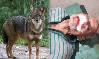 खेत से लौट रहे किसान पर जंगली सियार ने बोल दिया हमला