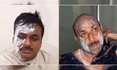 झाँसी : दो कबाड़ व्यापारी आपस में भिड़े, मारपीट के दौरान फेंका एसिड