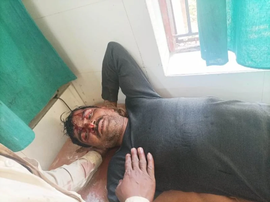 राठ में पुत्र ने पिता पर कुल्हाड़ी से किया हमला, गंभीर हालत में अस्पताल में भर्ती