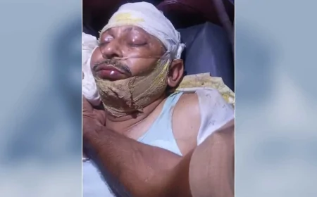 तेज रफ्तार थार की टक्कर से अर्दली की मौत, इलाज के दौरान तोड़ा दम