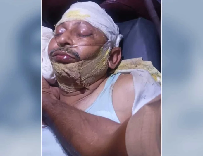 तेज रफ्तार थार की टक्कर से अर्दली की मौत, इलाज के दौरान तोड़ा दम