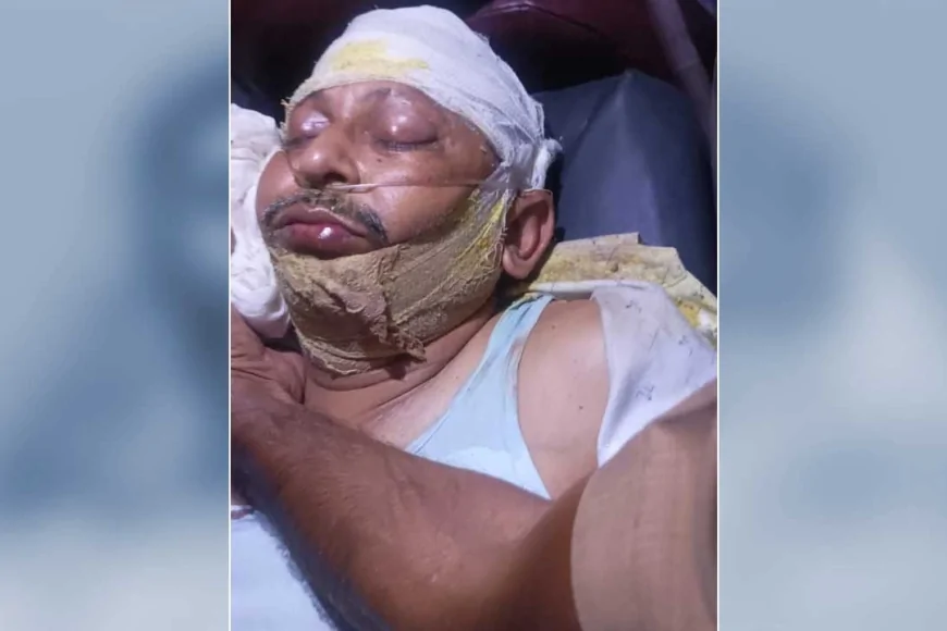 तेज रफ्तार थार की टक्कर से अर्दली की मौत, इलाज के दौरान तोड़ा दम