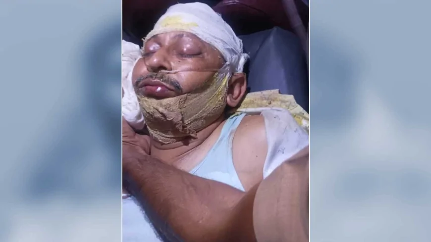 तेज रफ्तार थार की टक्कर से अर्दली की मौत, इलाज के दौरान तोड़ा दम