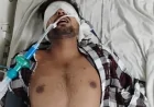 बांदा जेल में बड़ी लापरवाही: रिहाई वाले दिन कैदी पहुंचा गहरे कोमा में, अस्पताल में छोड़कर पुलिसकर्मी फरार